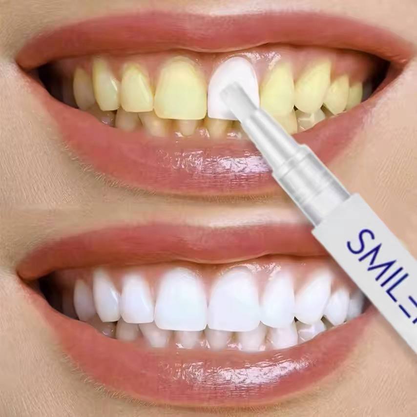 Smile kit brand teeth whitening pen image 4